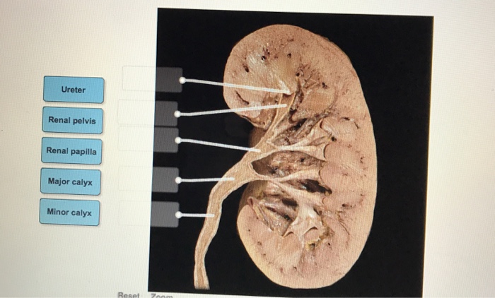 solved-ureter-renal-pelvis-renal-papilla-major-calyx-minor-chegg