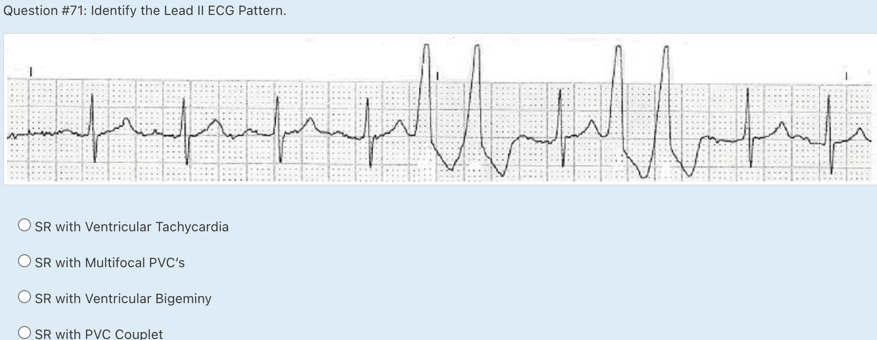 Solved Question #62: Identify The Following Lead II ECG | Chegg.com