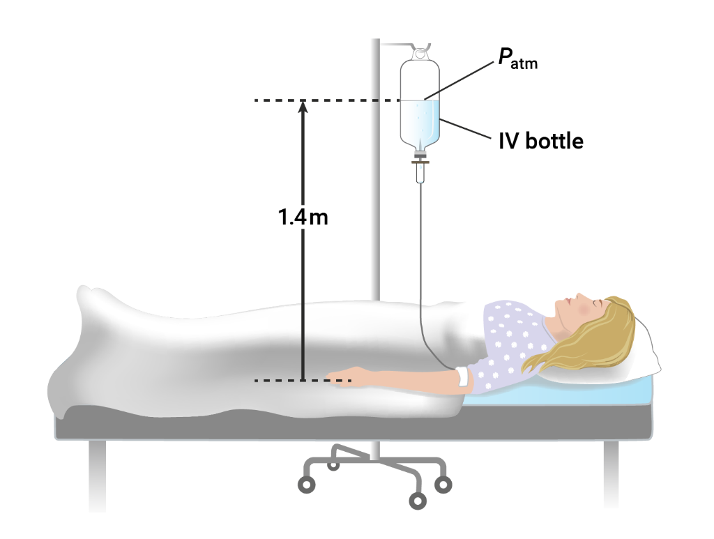 Solved The majority of intravenous infusions IVs done in Chegg