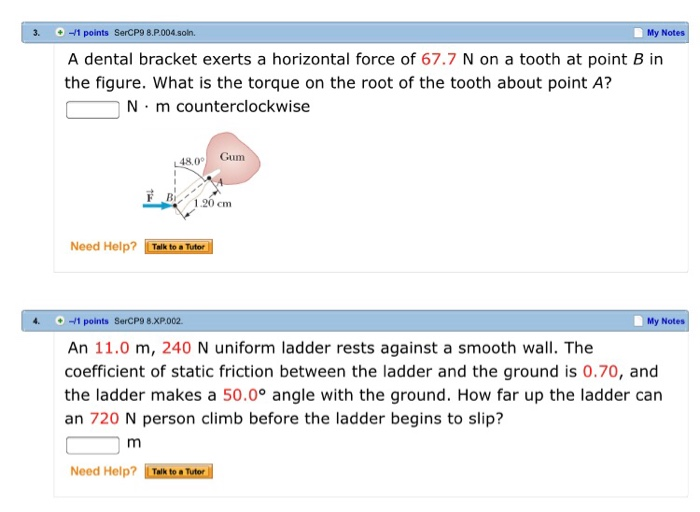 Solved My Notes 1 points SerCP98.P004.soin. A dental bracket