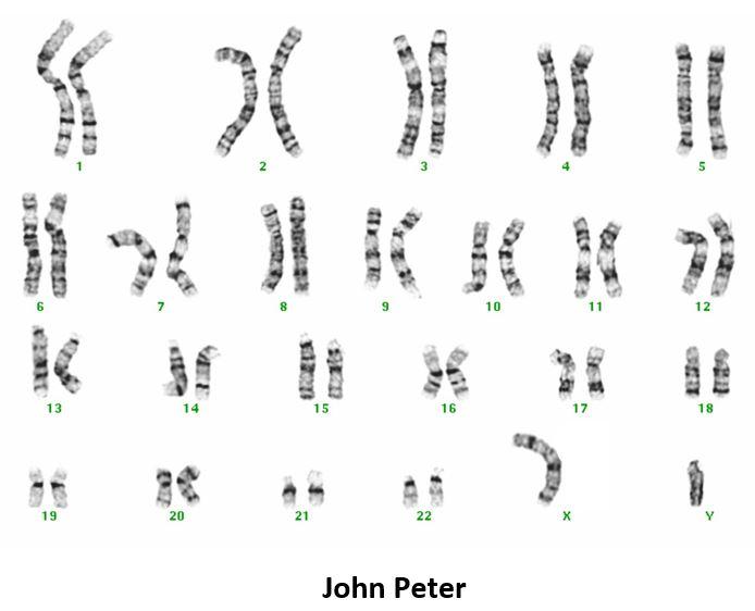 Solved Give chromosomal constitution of both Karyotypes | Chegg.com