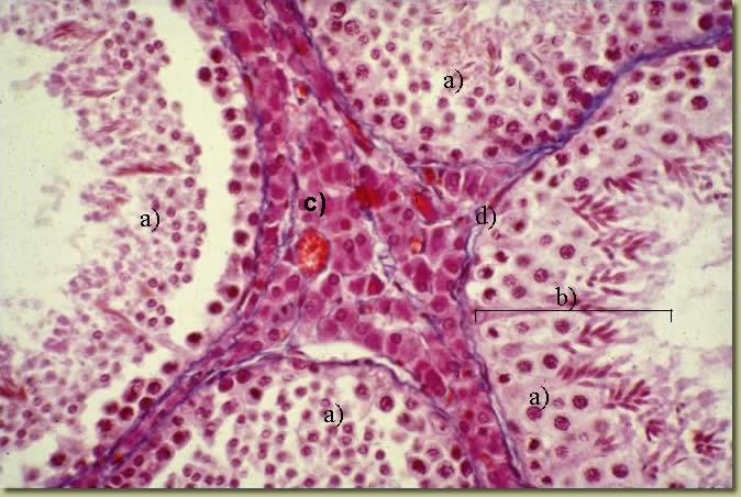 labeled epididymis microscope slide