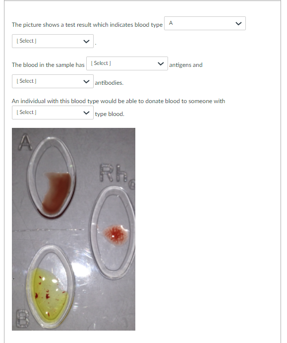 solved-the-picture-shows-a-test-result-which-indicates-blood-chegg