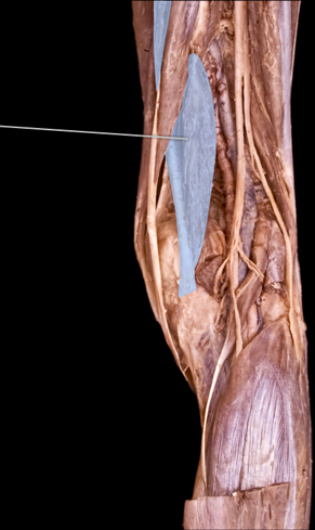 Solved What Is An Action Of The Highlighted Muscle? A. | Chegg.com