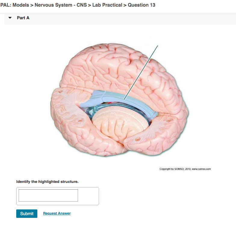 Solved PAL Models > Nervous System CNS > Lab Practical >