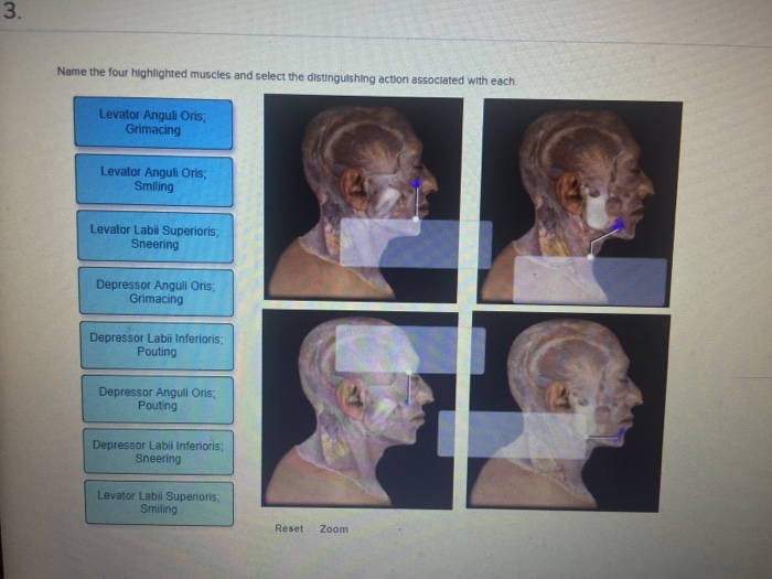 Solved 3. Name the four highlighted muscles and select the Chegg