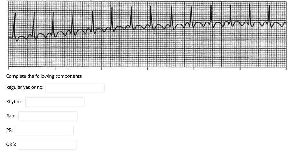 Complete the following components Regular yes or no: Rhythm: Rate: PR: QRS: