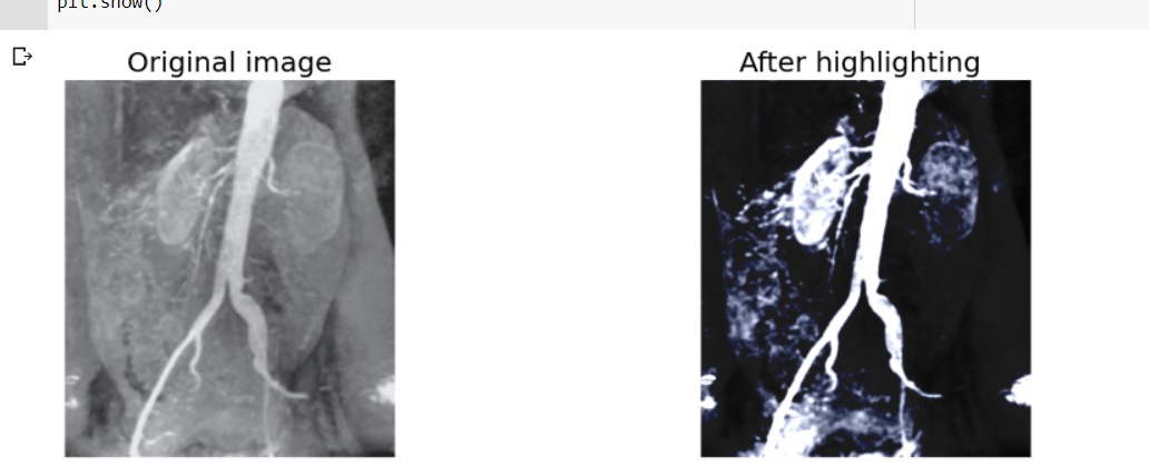 Solved Hello, Why does my output image kind of have a blue | Chegg.com