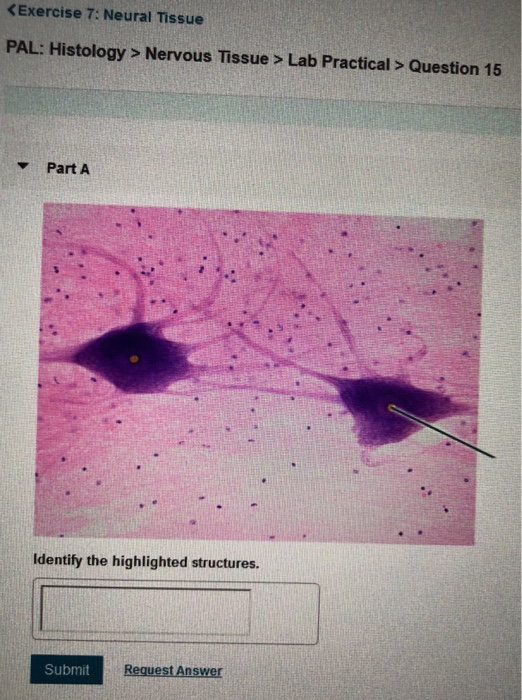 Solved Nervous Tissue > Lab Practical > Question 11 Part A | Chegg.com