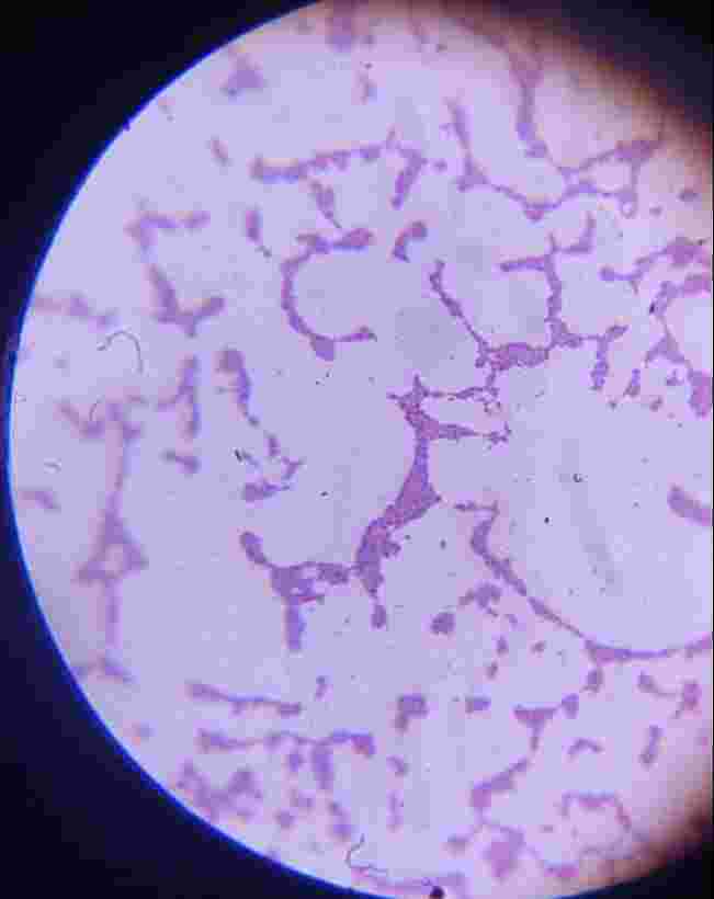Solved write a lab report on gram staining | Chegg.com