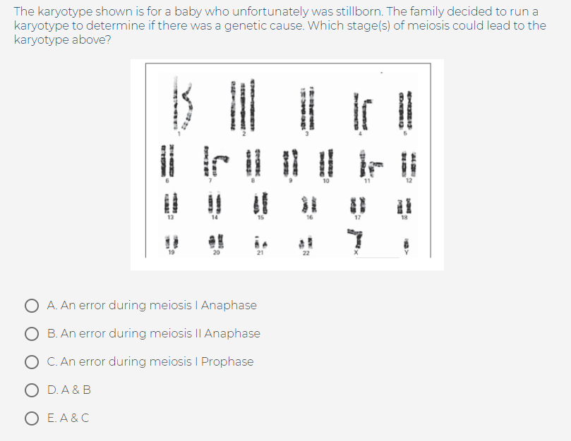 Solved The karyotype shown is for a baby who unfortunately | Chegg.com