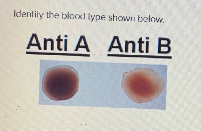 Solved Identify The Blood Type Shown Below Anti A Anti B | Chegg.com