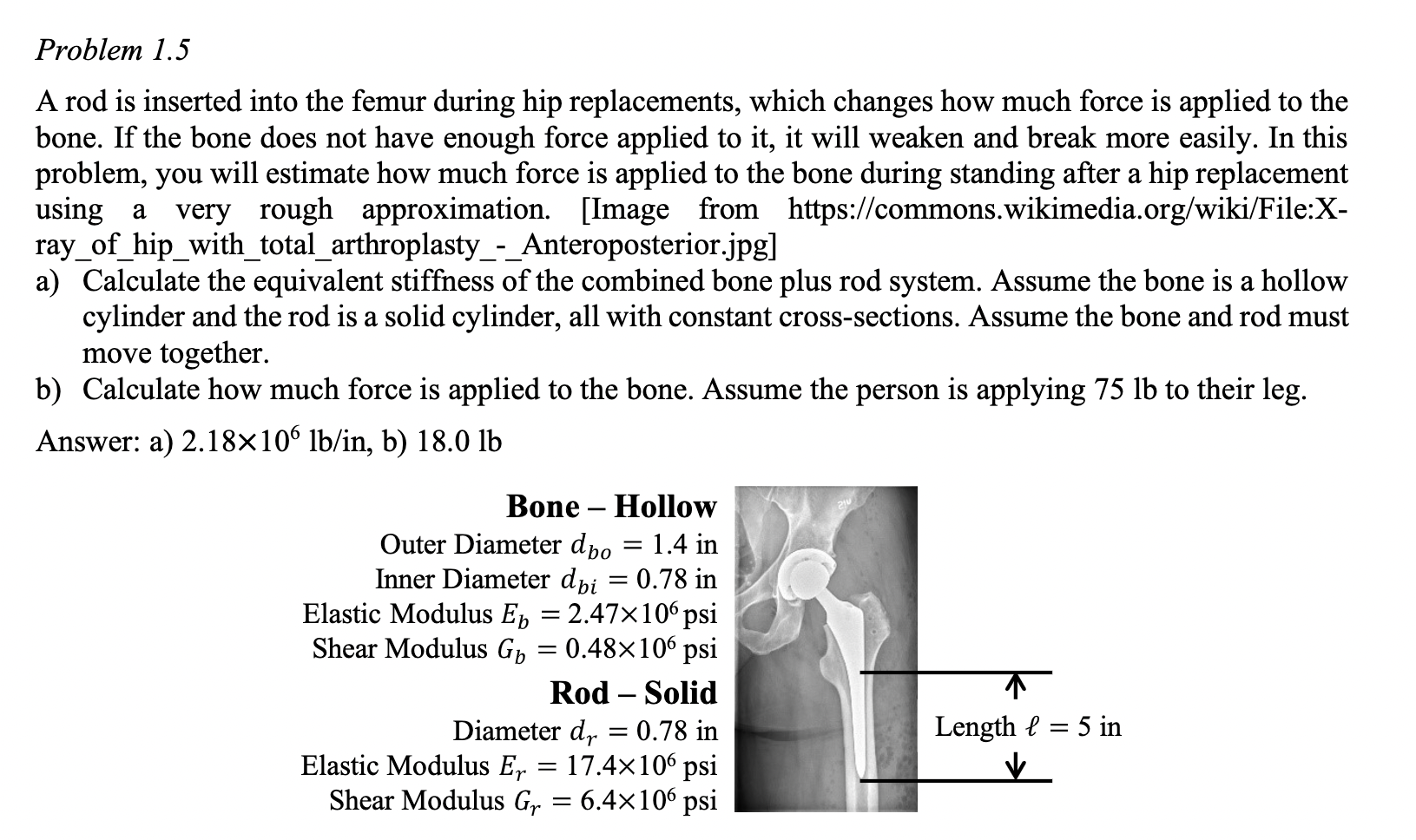 Solved A rod is inserted into the femur during hip