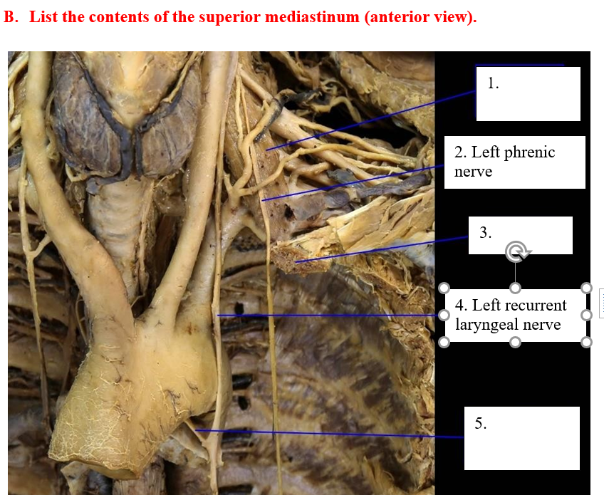 superior mediastinum cadaver