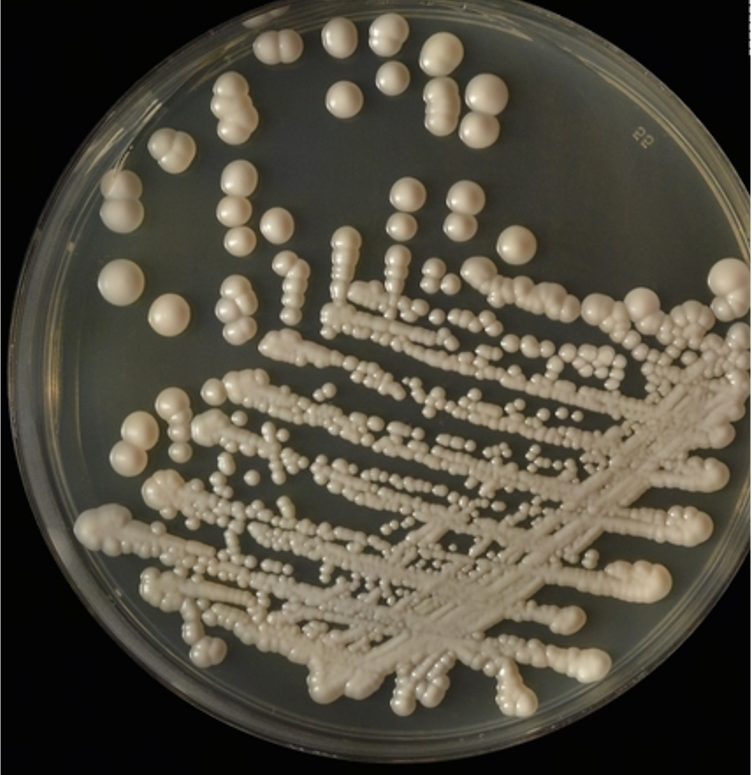 Solved What is the technique used for inoculating the agar | Chegg.com