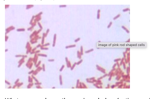 Solved What Is The Mechanism Of Endospore Stain And Or Cheggcom