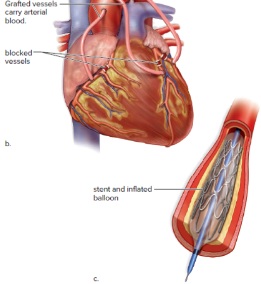 Solved 26. How many clotting factors are required for blood | Chegg.com