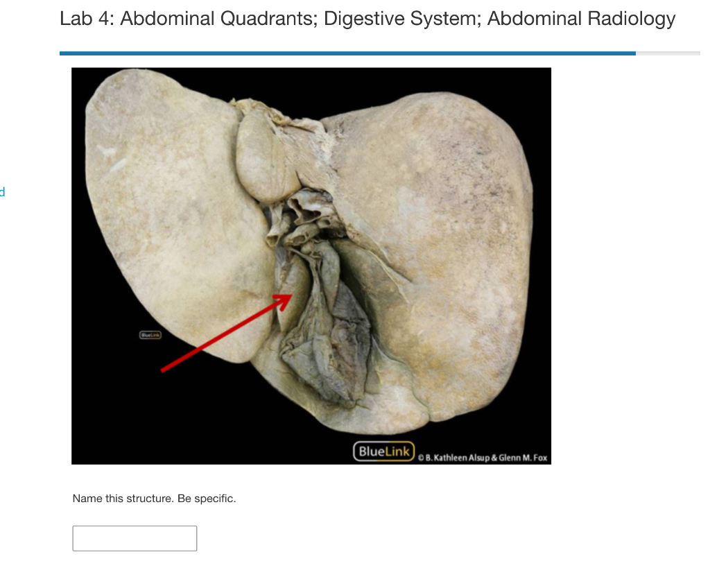 Solved Lab 4: Abdominal Quadrants; Digestive System; | Chegg.com