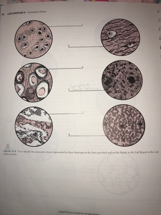 solved-connective-tissue-lab-exercise-8-74-fiqure-8-3-try-to-chegg