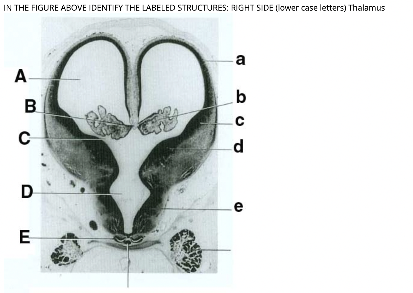Solved IN THE FIGURE ABOVE IDENTIFY THE LABELED STRUCTURES: | Chegg.com