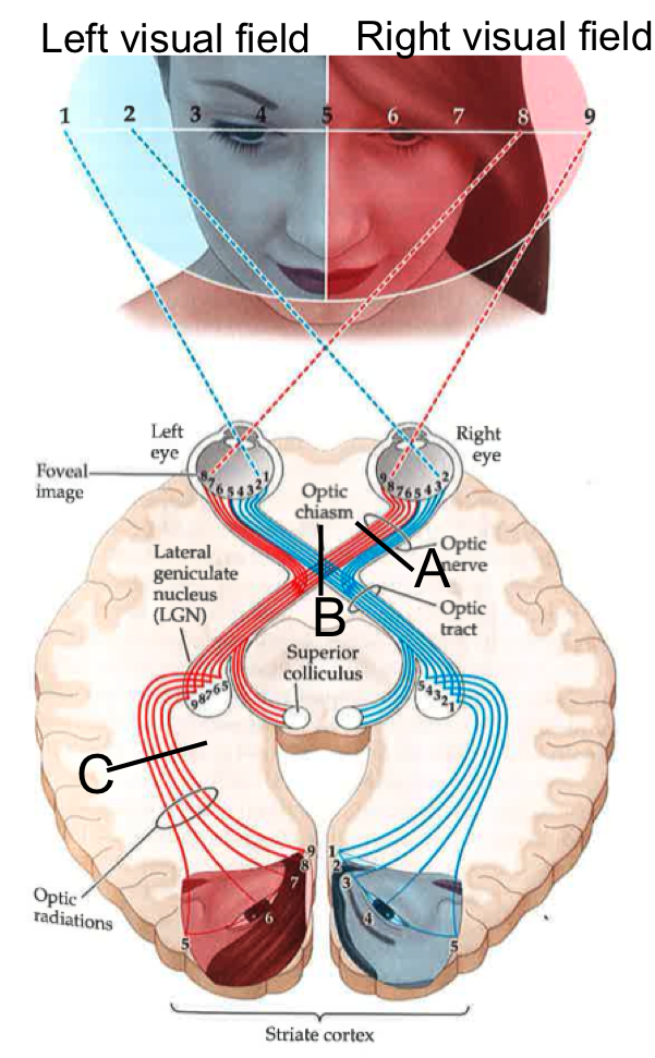 Solved Info from the visual field is picked up from both | Chegg.com