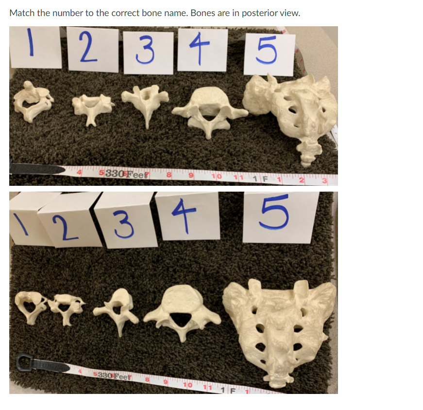 Solved Match the number to the correct bone name. Bones are 