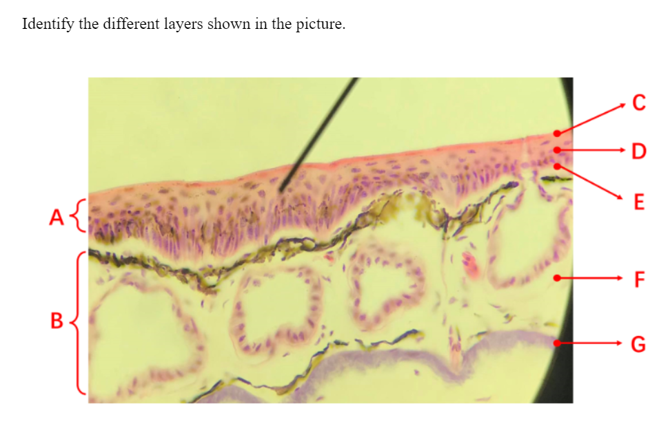 Solved Identify the different layers shown in the picture. | Chegg.com