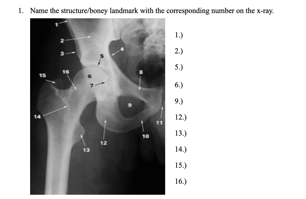 1. Name the structure/boney landmark with the | Chegg.com