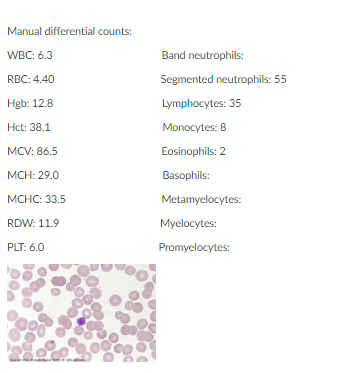 Solved 1. Describe the peripheral blood findings. 2. What | Chegg.com