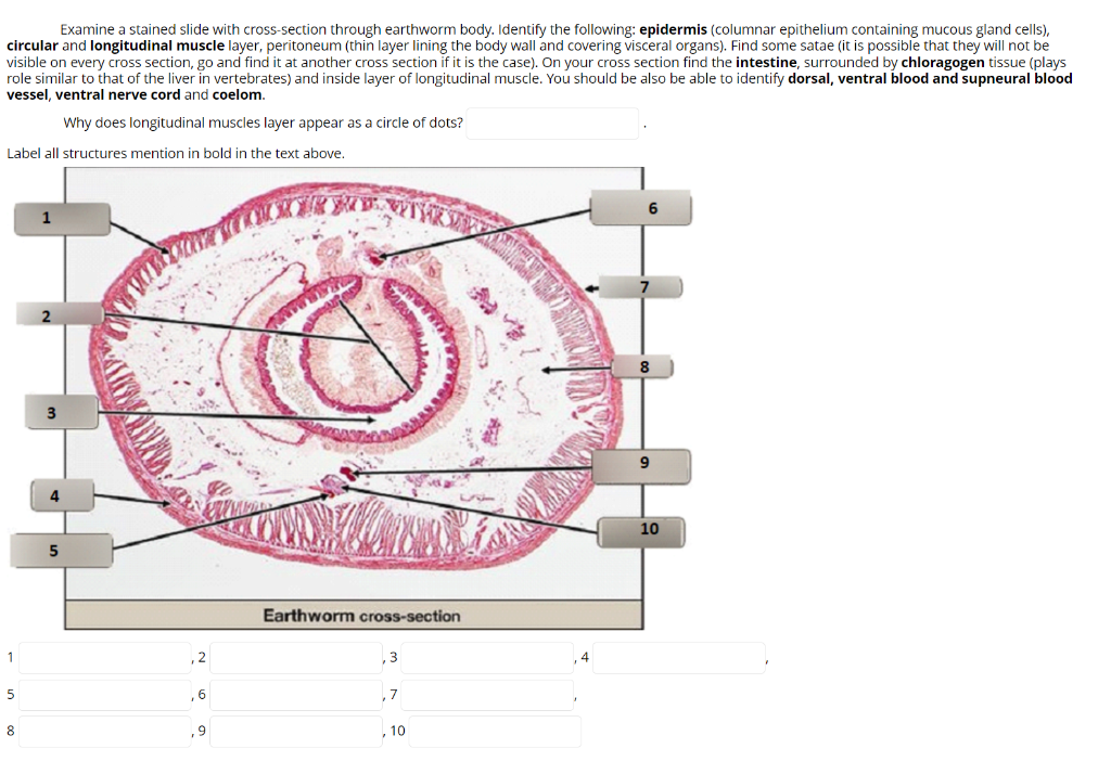 Earthworm Cross Section Labeled
