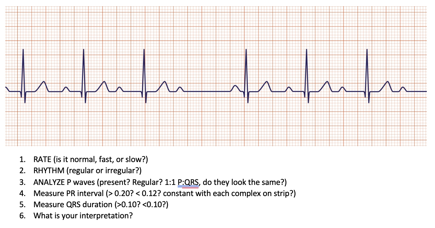 Solved 1. RATE (is it normal, fast, or slow?) 2. RHYTHM | Chegg.com