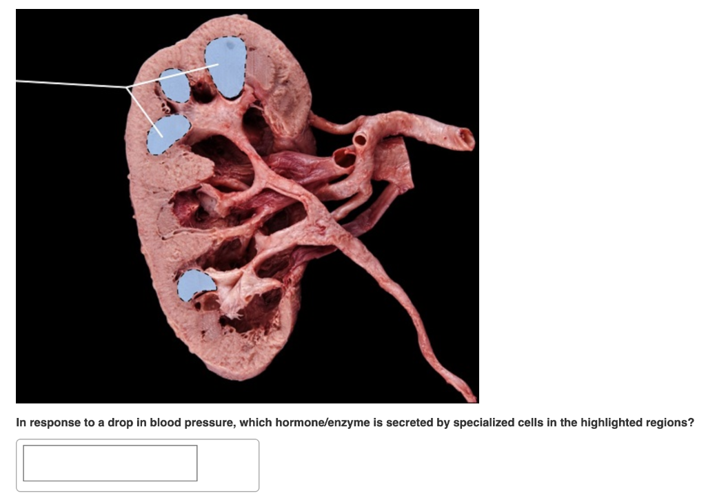 Solved In response to a drop in blood pressure, which