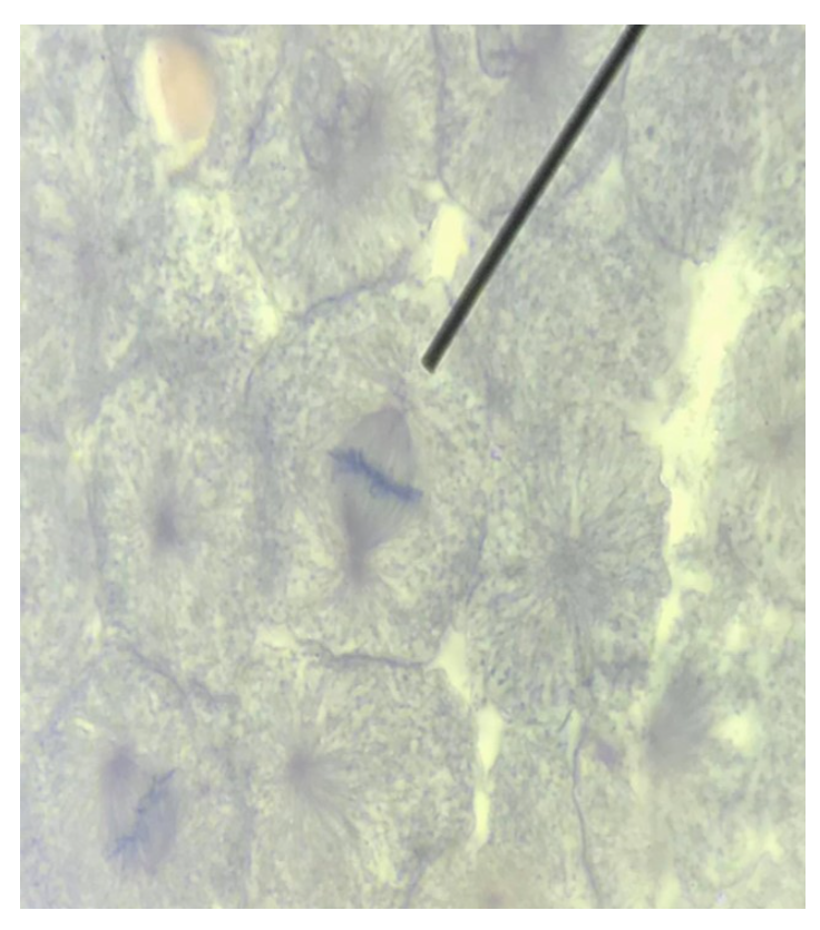 Solved Where does the spindle fibers attach to Biology Diagrams