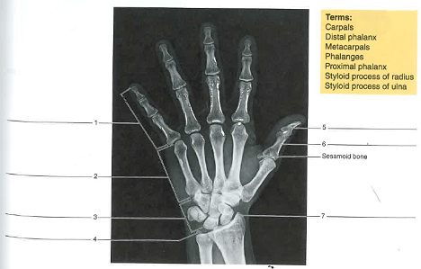Identify the bones and features indicated in the radiograp... | Chegg.com