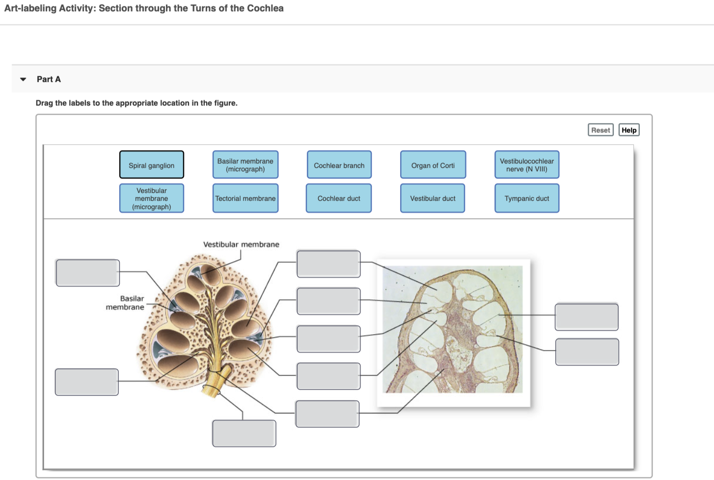 Solved Art-labeling Activity: Section through the Turns of | Chegg.com