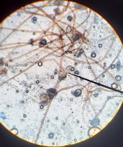 fungi microscope
