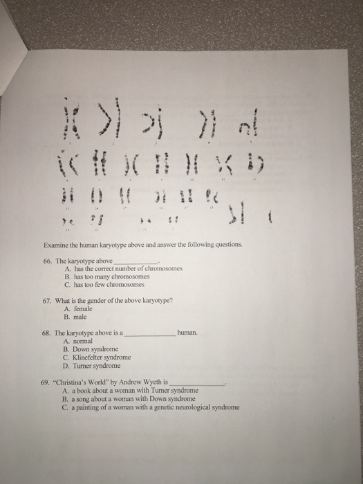 Solved Examine The Human Karyotype Above And Answer The | Chegg.com