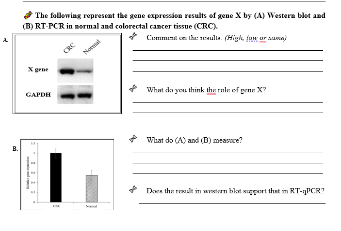 The following represent the gene expression results of gene \( X \) by (A) Western blot and (B) RT-PCR in normal and colorect