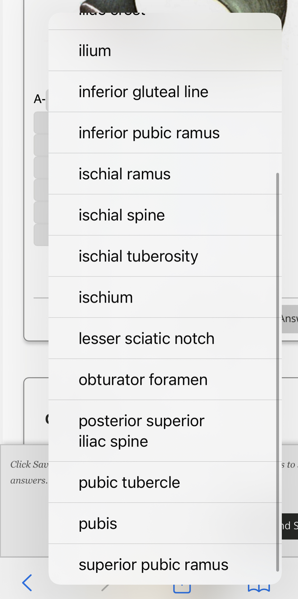 Solved acetabulum Aanterior inferior iliac spine anterior | Chegg.com