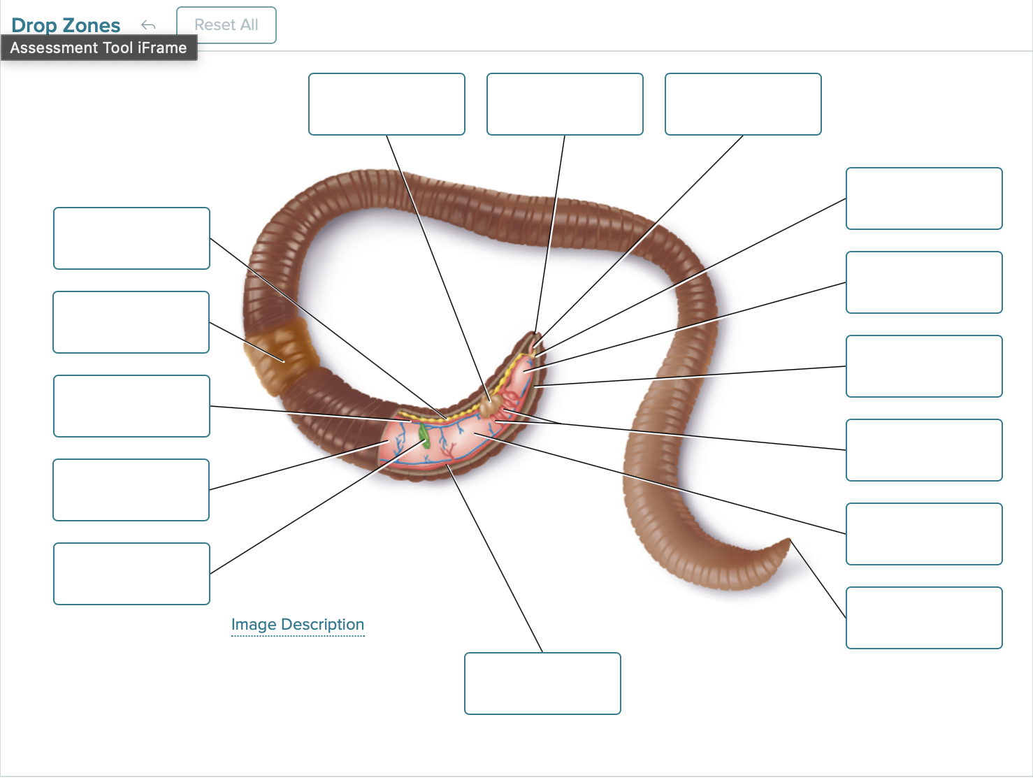 Label the image below of the anatomy of an earthworm