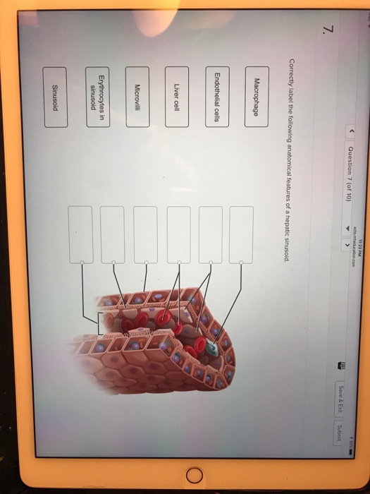 Solved 7. Liver cell | Chegg.com