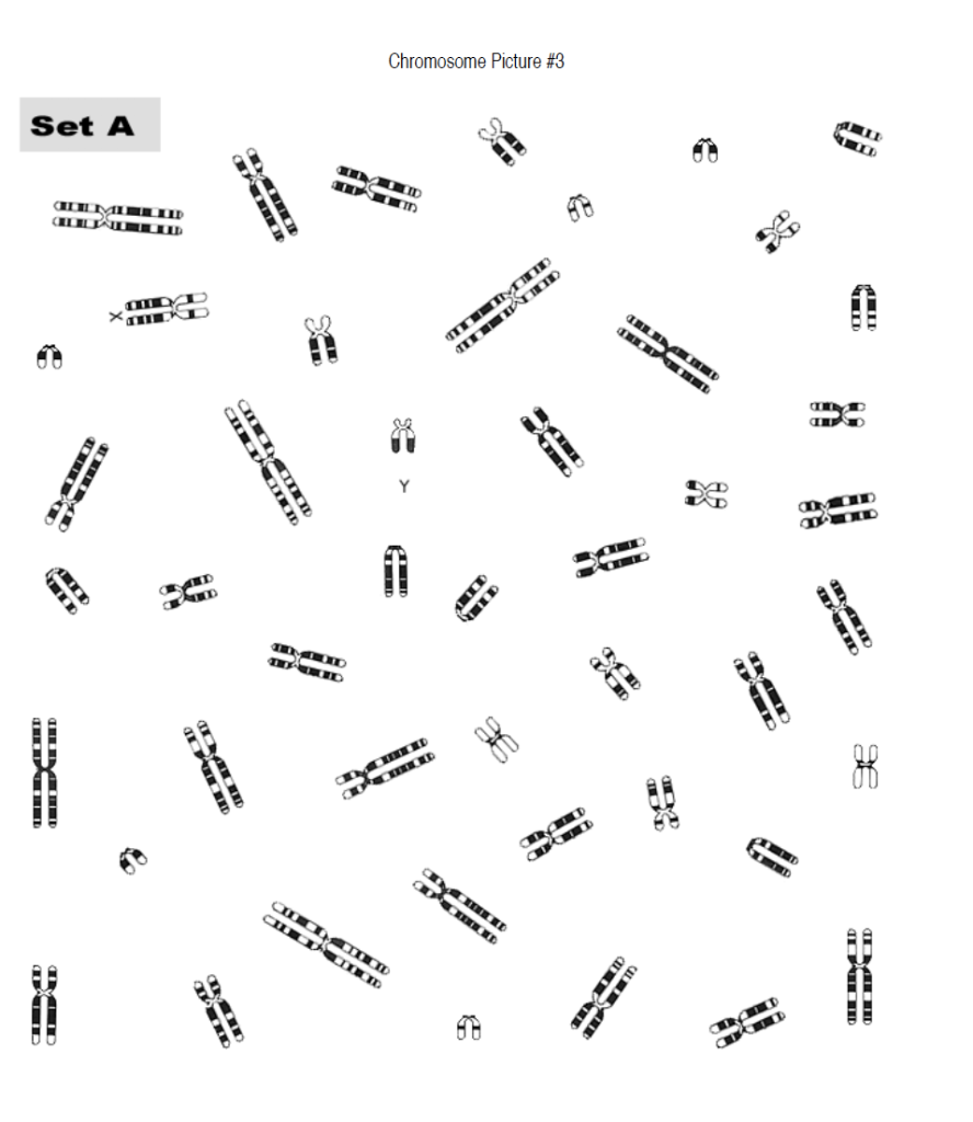 Solved Observe four different karyotypes provided by your | Chegg.com