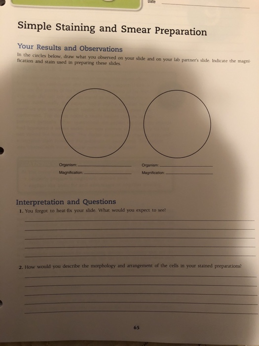 Solved Simple Staining and Smear Preparation Your Results