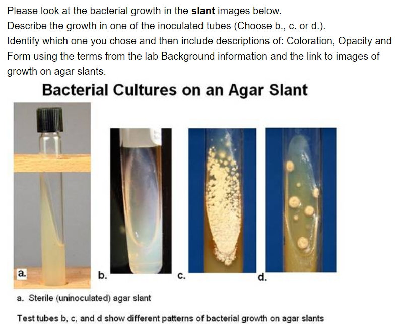 Solved Background For Microbial Growth On Slants And Broths | Chegg.com