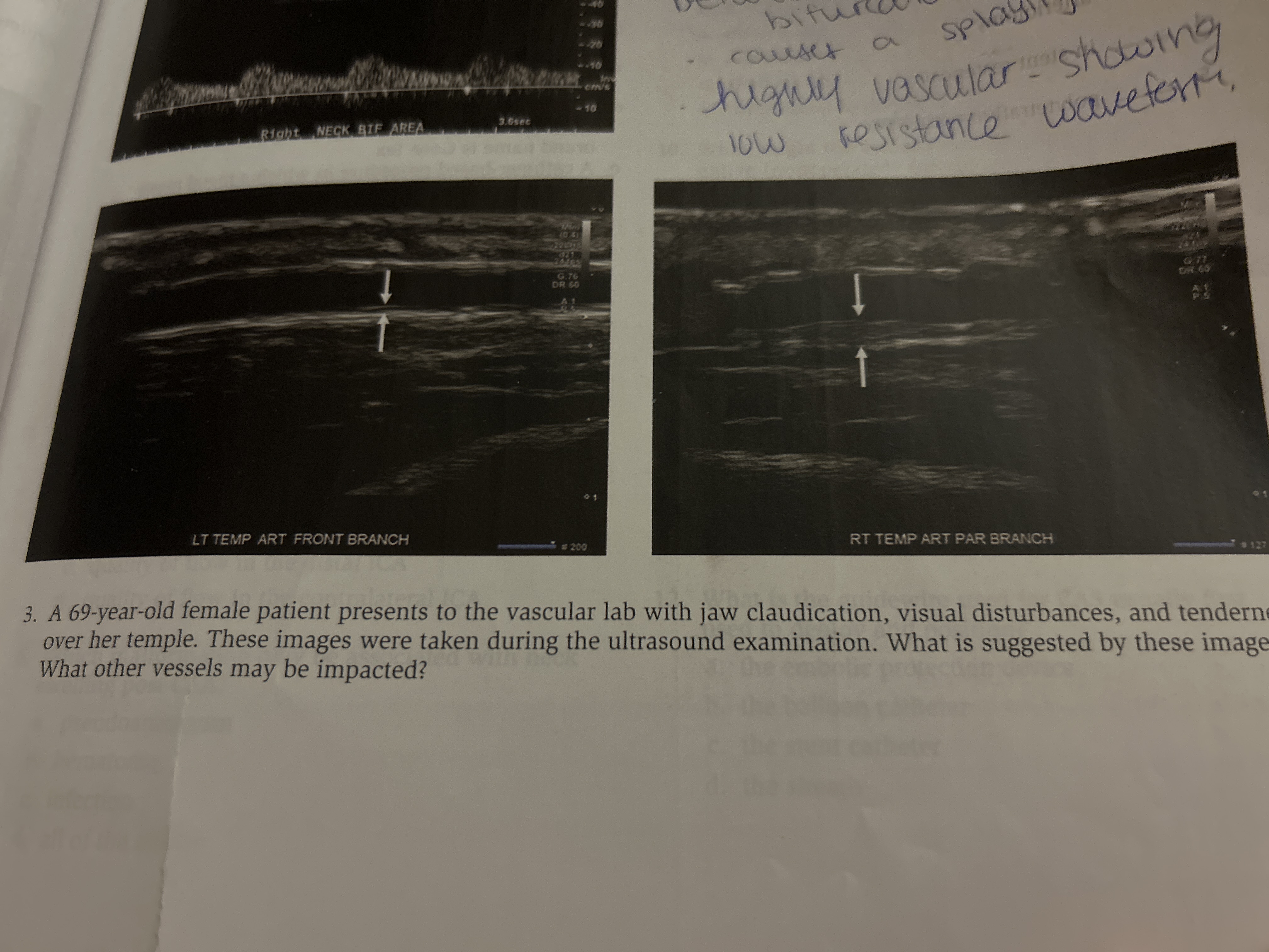 Solved A 72 year old female patient present to the vascular | Chegg.com