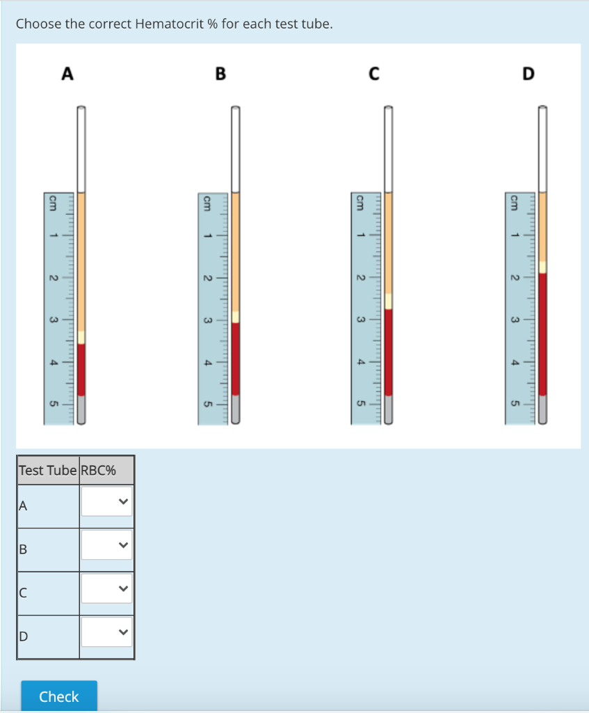 Solved Choose the correct Hematocrit for each test tube. А