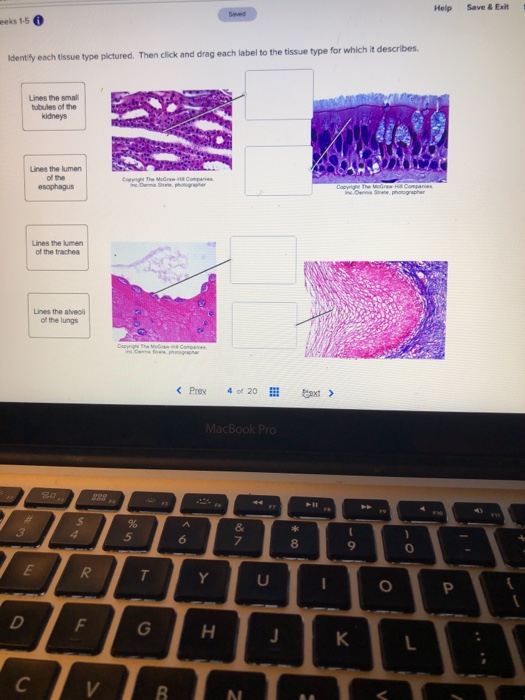 Solved Help Save&Exit eeks 1.5。 idently each tissue type | Chegg.com