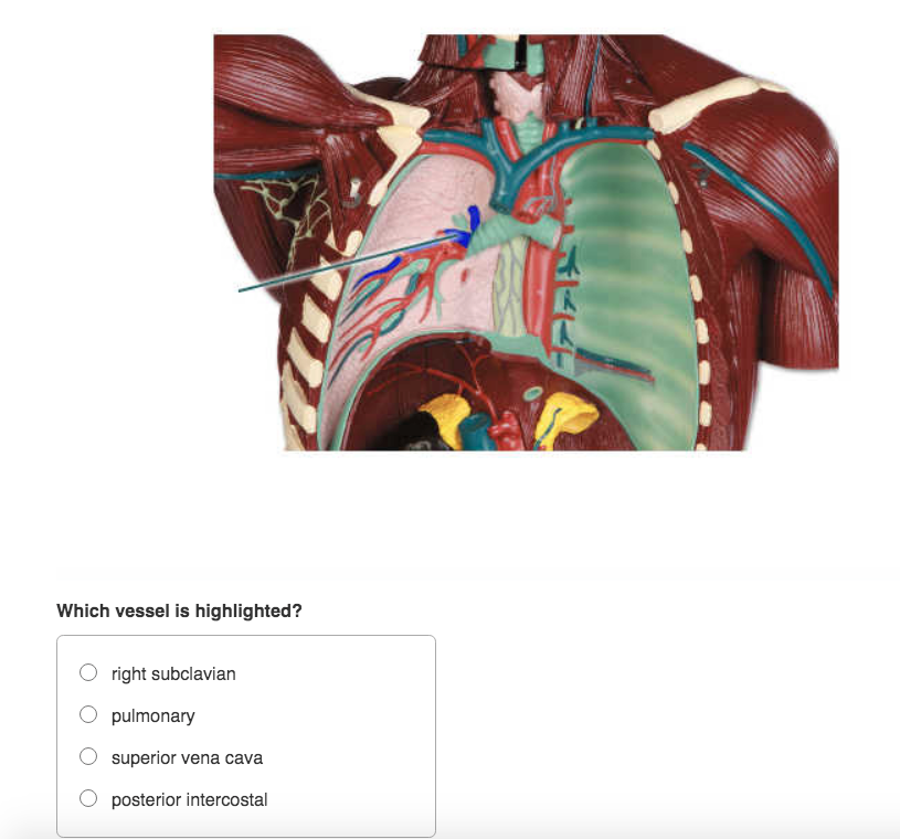 Solved Which structures are highlighted? Identify the | Chegg.com