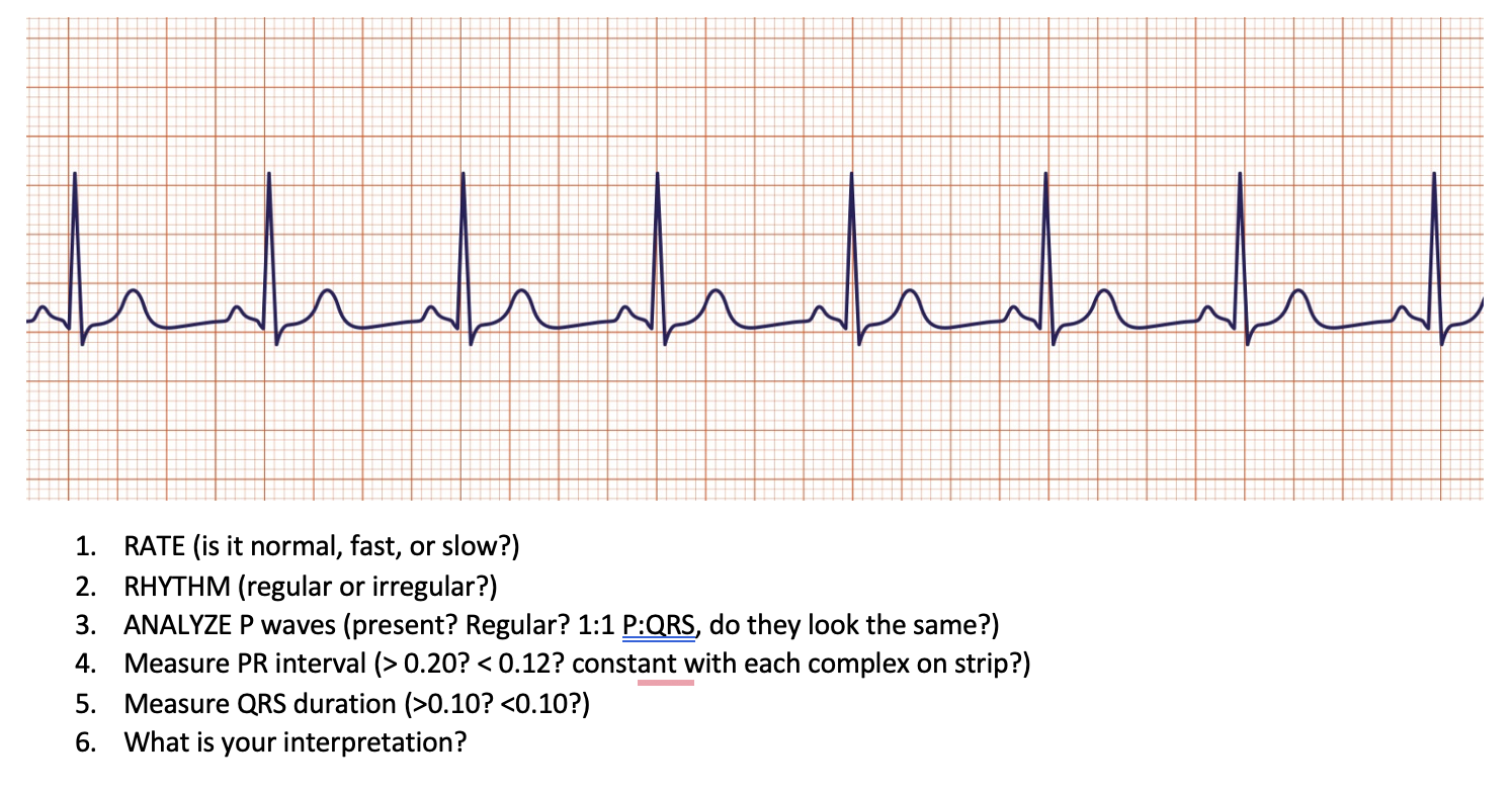 Solved 1. RATE (is it normal, fast, or slow?) 2. RHYTHM | Chegg.com