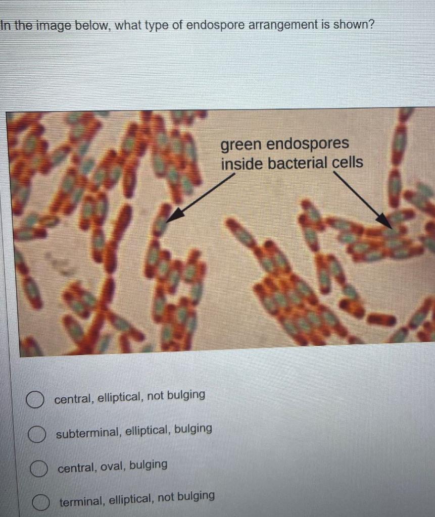 Solved In The Image Below, What Type Of Endospore | Chegg.com